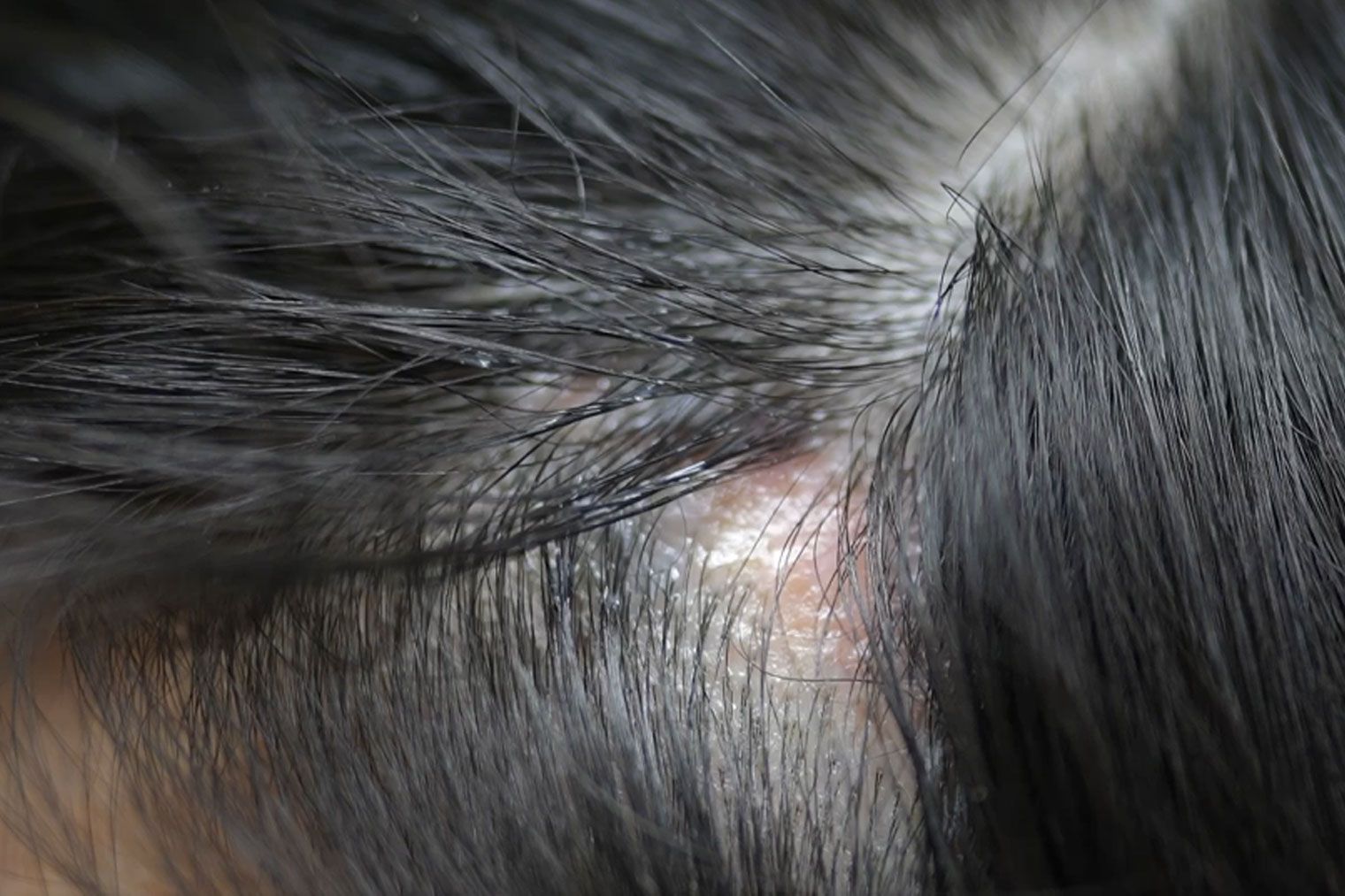 dr CYJ Hair Filler Amsterdam Unicare Cosmetic Clinic